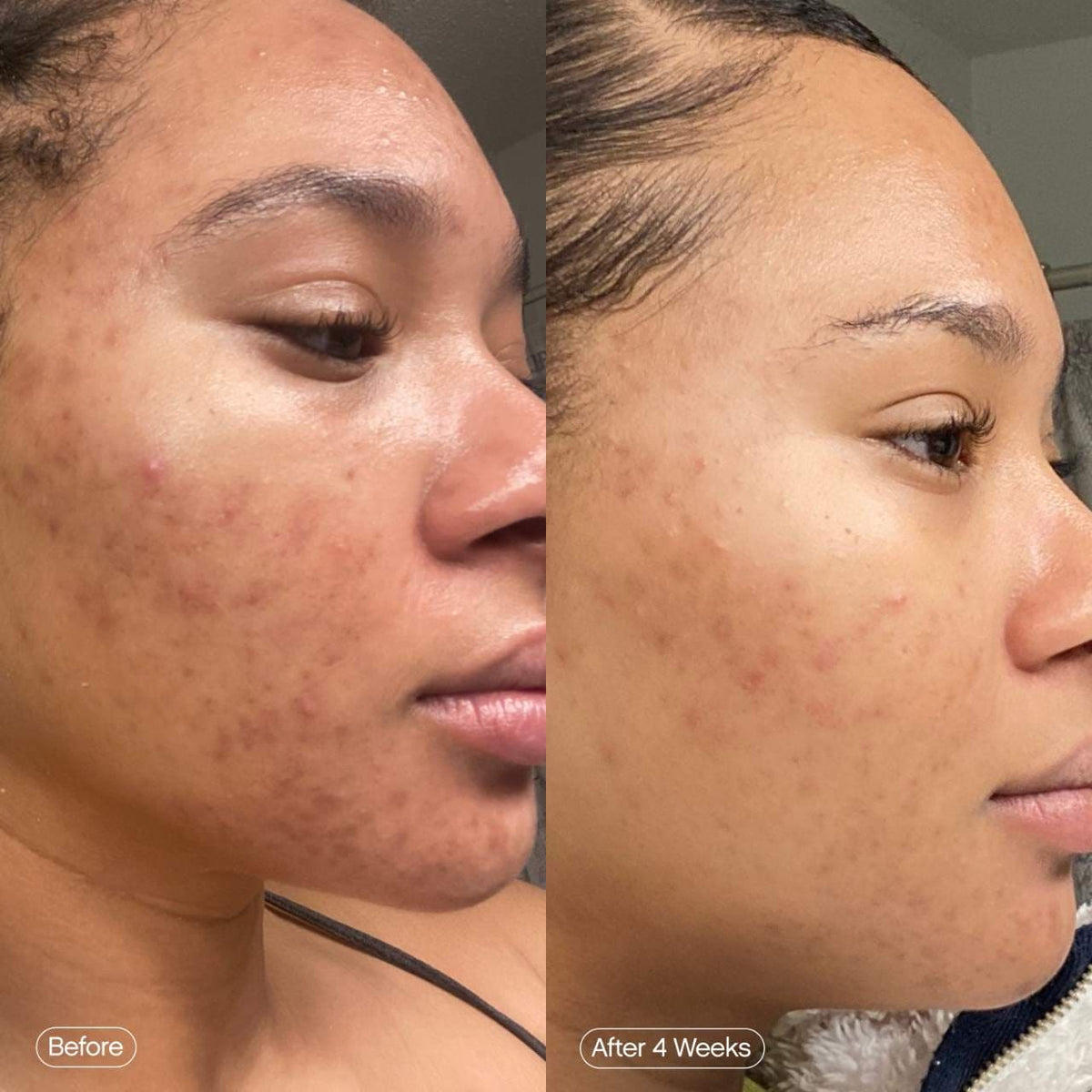 Topicals *Mini* Faded Serum for Dark Spots & Discoloration