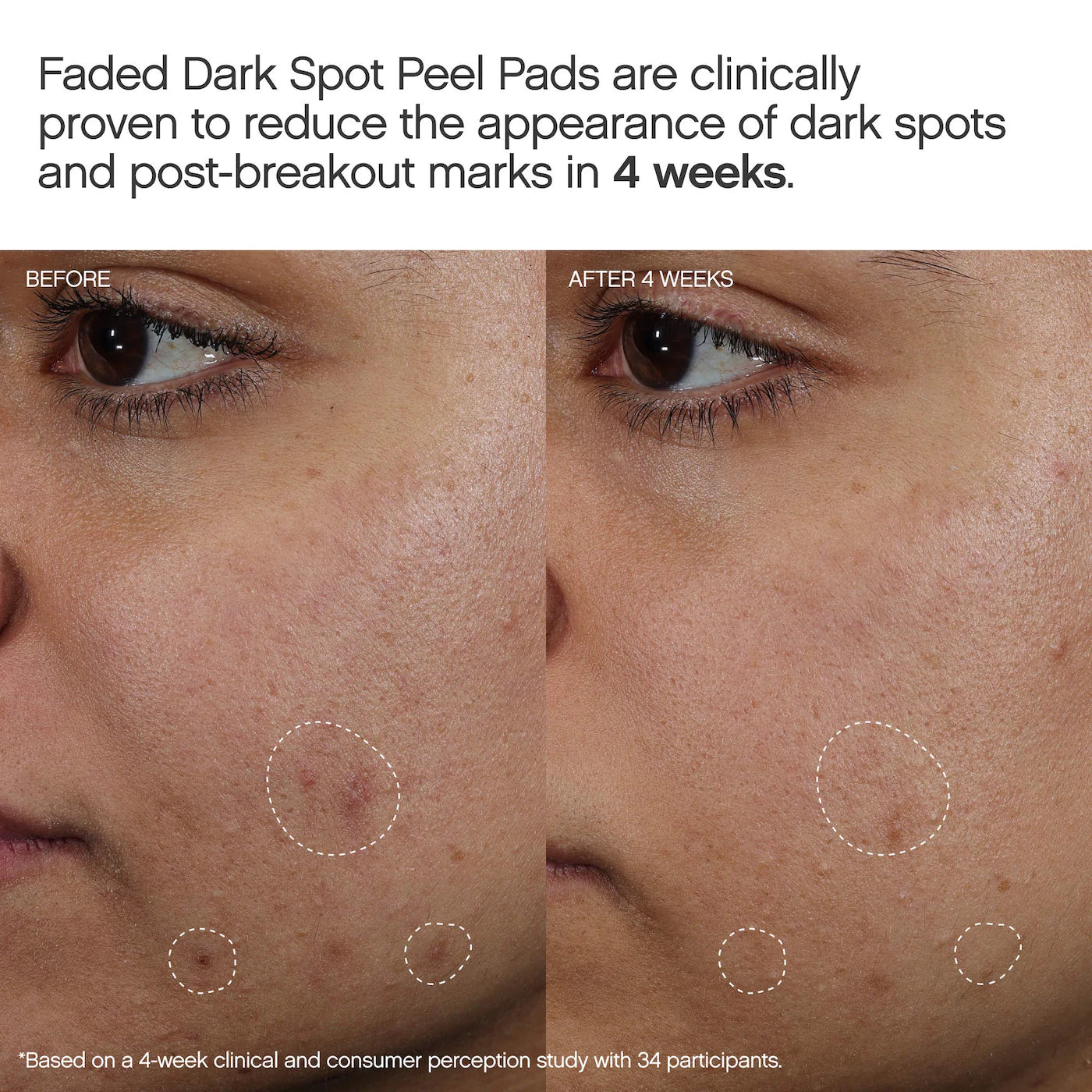 Topicals Faded Brightening Peel Pads for Dark Spots, Discoloration & Uneven Skin Tone (12 pack)